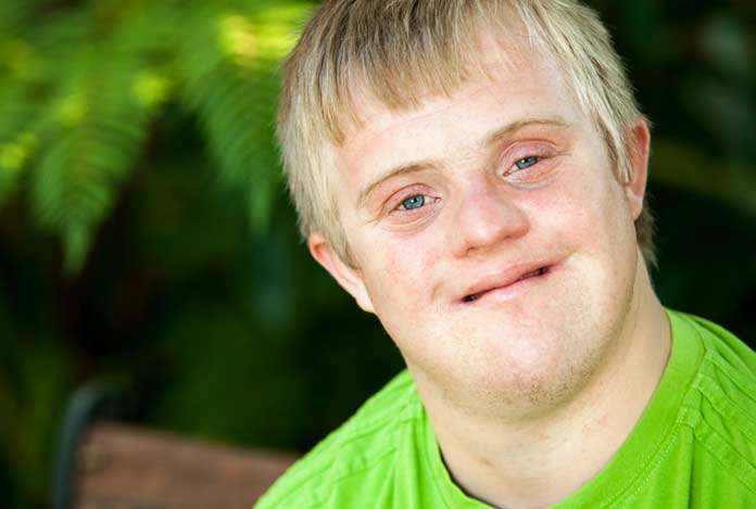 Aarskog Syndrome - Causes, Symptoms, Diagnosis & Treatment