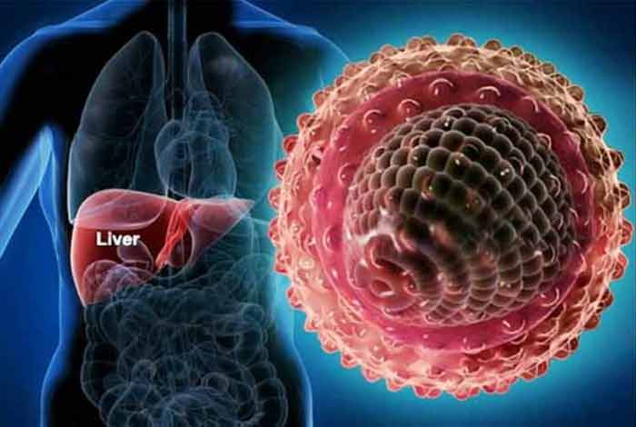 viral hepatitis types symptoms causes prevention and treatment
