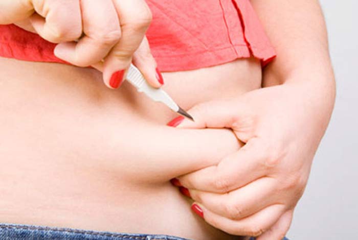 how effective are weight loss surgeries