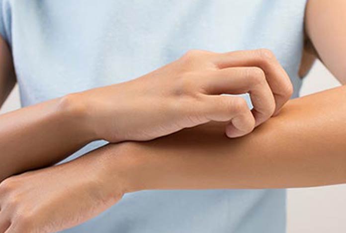 Treating Eczema with Vitamin B12 Cream Treating Eczema with Vitamin B12 Cream